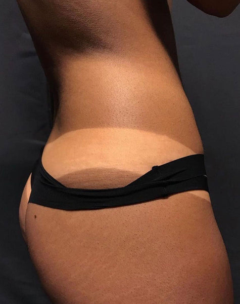 Absolute Pro Spray Mist MineTan Body Skin